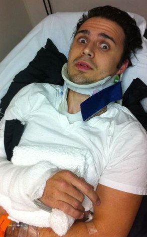 Kris Allen Broken arm